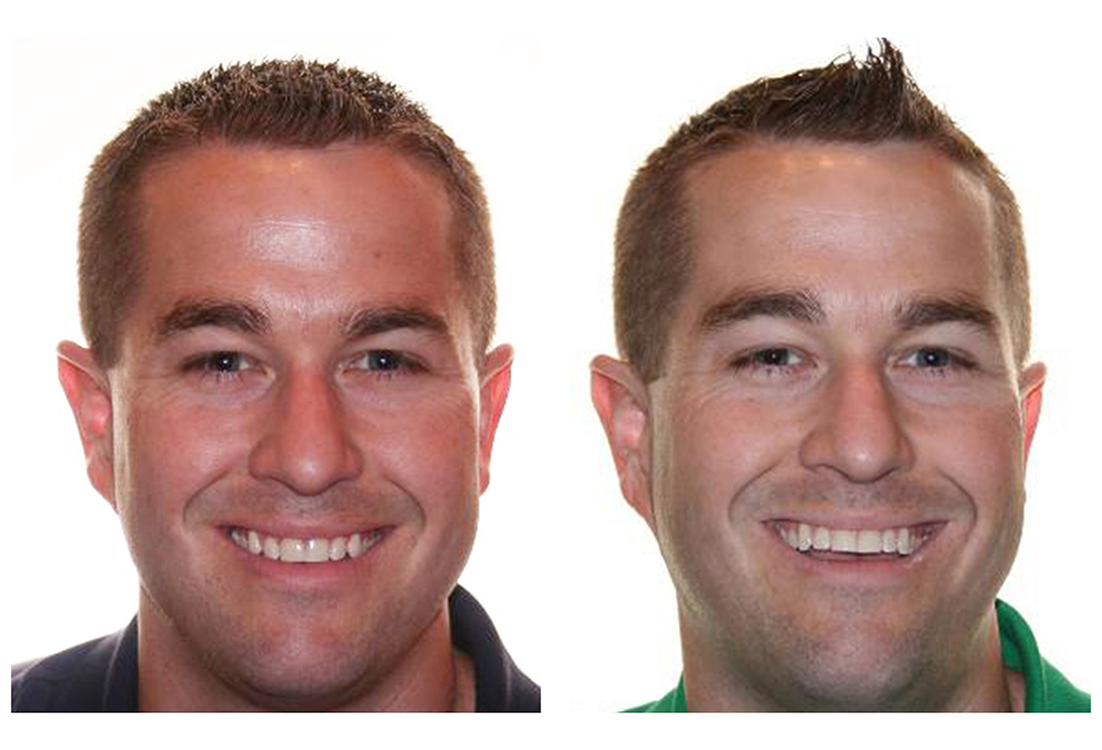 Innovative Dental | Root Canals, Implant Restorations and Digital Impressions