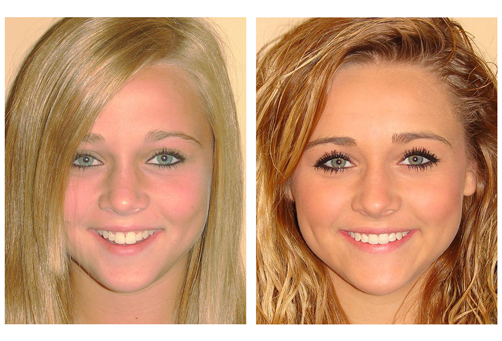 Innovative Dental | CBCT, Dentures and Emergency Treatment